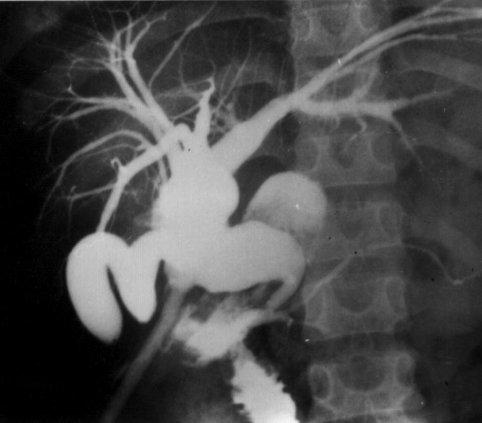 Cbd3.jpg (52524 bytes)